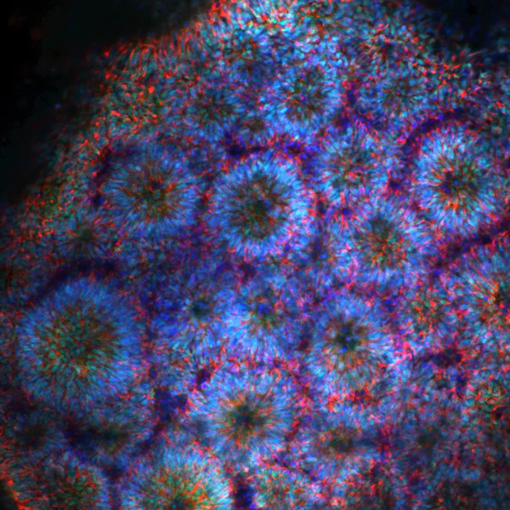 Fluorescence micrograph of human neural progenitor cells